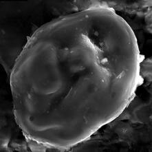 Microfossil exposed on a shale bedding plane and imaged by scanning electron microscopy.