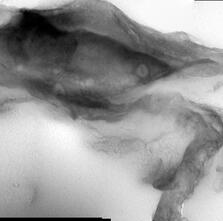 Interior structure of a microfossil imaged through transmission electron microscopy.